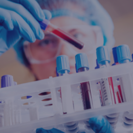 ДИАГНОСТИКА ДЖ И ЖДА